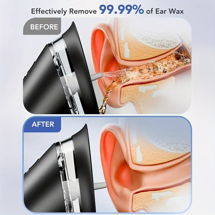 Electric Ear Wax Removal for Adults